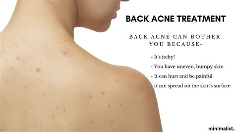 Back Acne Causes: How Shower Habits Affect Your Skin.